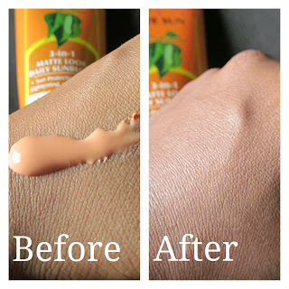 aloe freeze spray gel