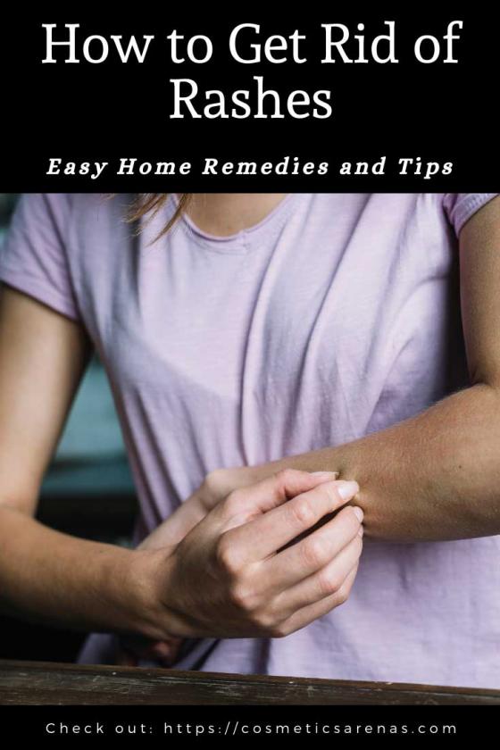 How To Get Rid Of Rashes Easy Home Remedies And Tips