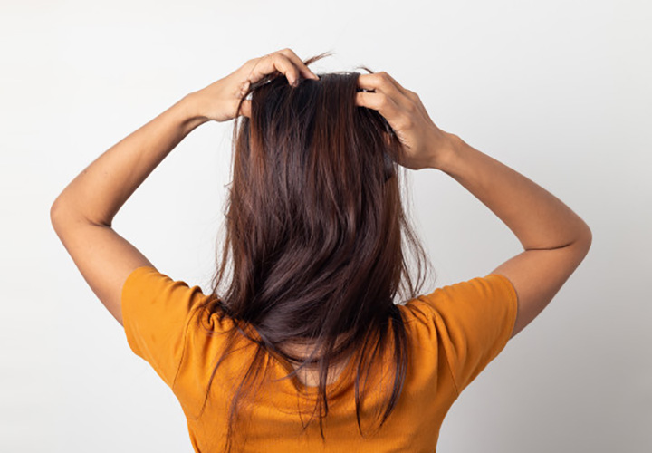 4 Tips that Have Helped Me to Get Rid of the Stubborn Dandruff