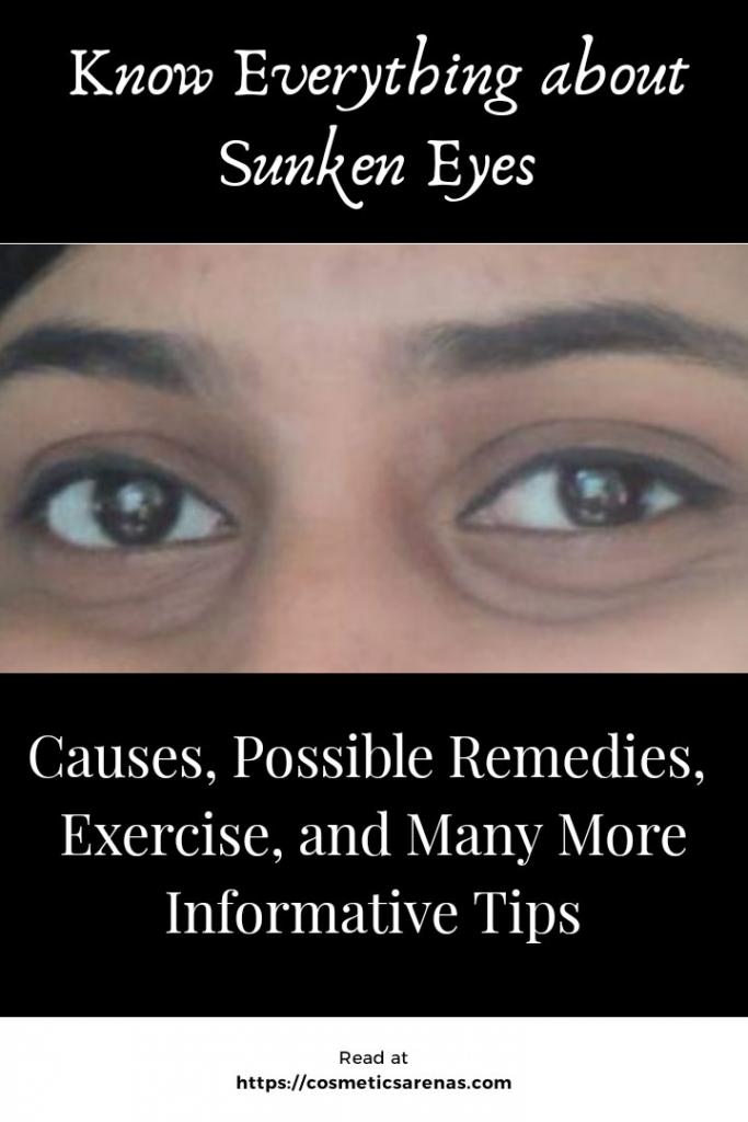 Sunken Eyes Causes Remedy Exercise and Many Other Informative Tips