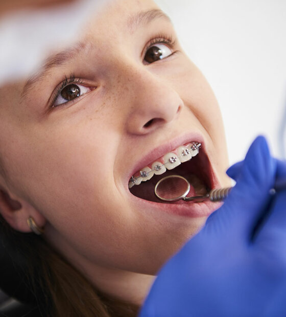 How Does Orthodontic Treatment Work?