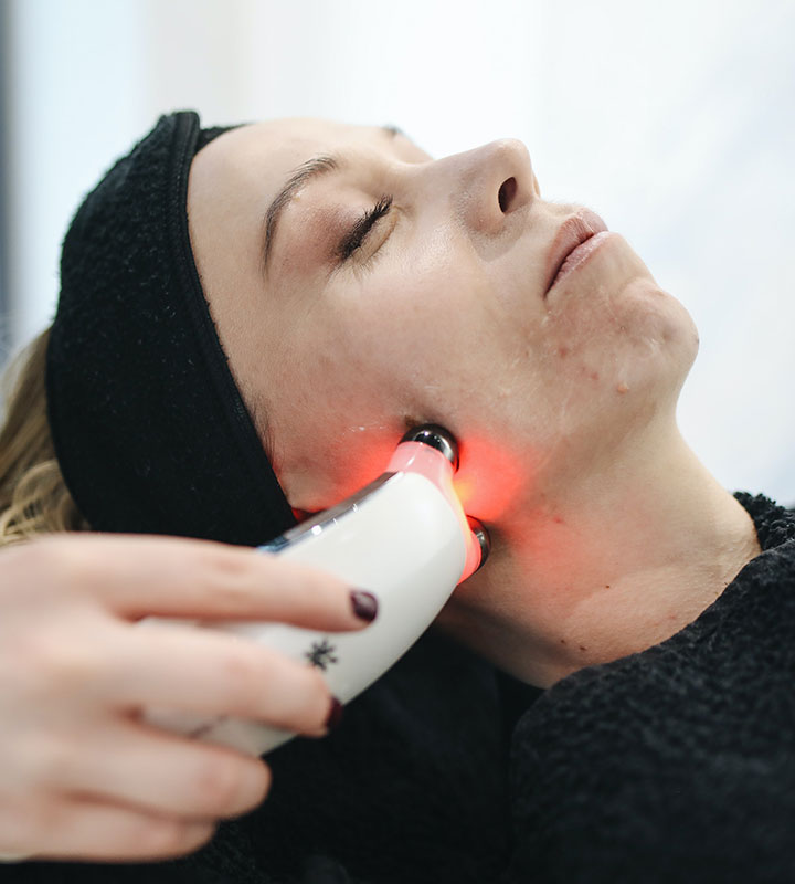 Know Everything about Laser Skin Resurfacing