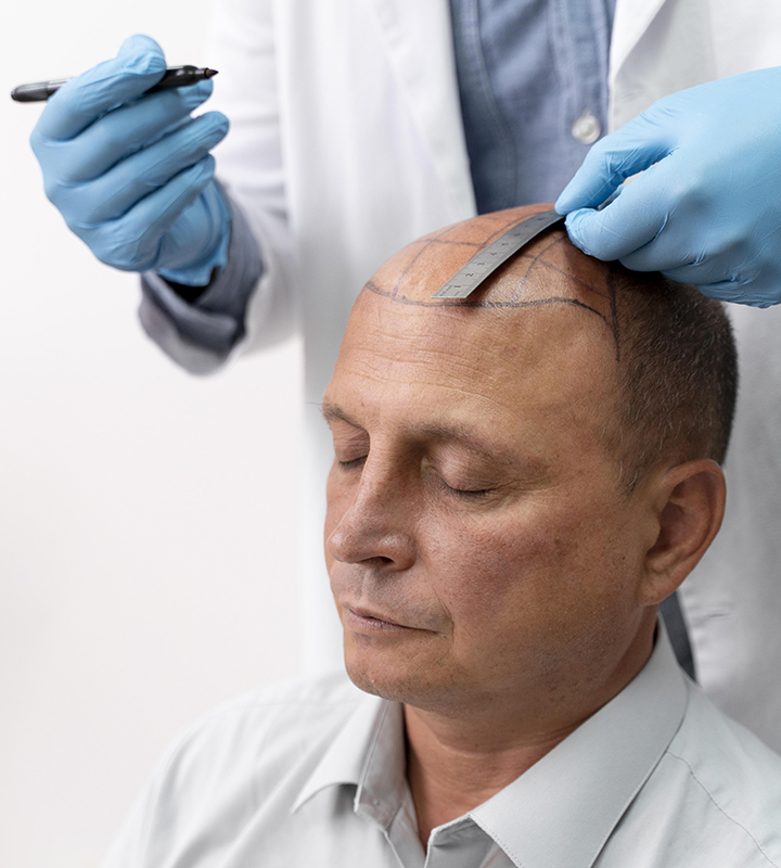 Why Turkey is Considered the Best Place for Hair Transplantation