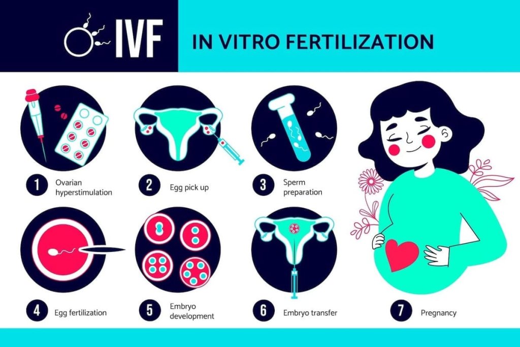 Process Risks and Side Effects of IVF