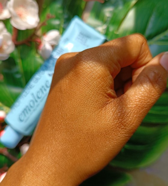 Emolene Cream Uses Ingredients Side Effects Review