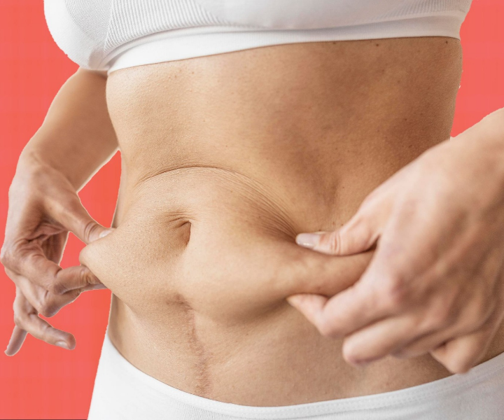 Why Lipolysis is Great in Comparison to Ancient Approaches