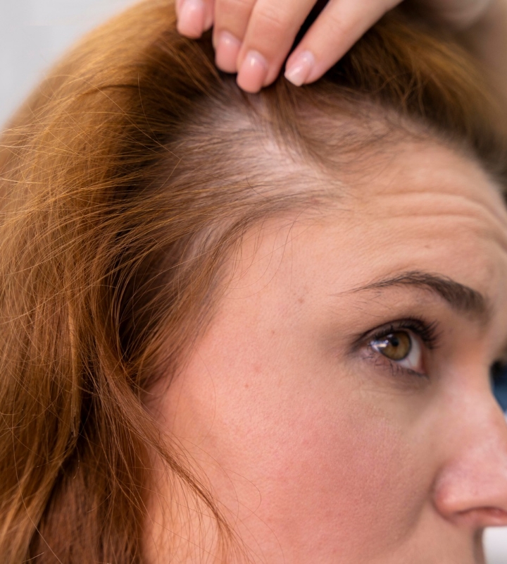 How to Transform Your Hair Thinning